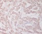 Anti-Beclin 1 BECN1 Monoclonal Antibody